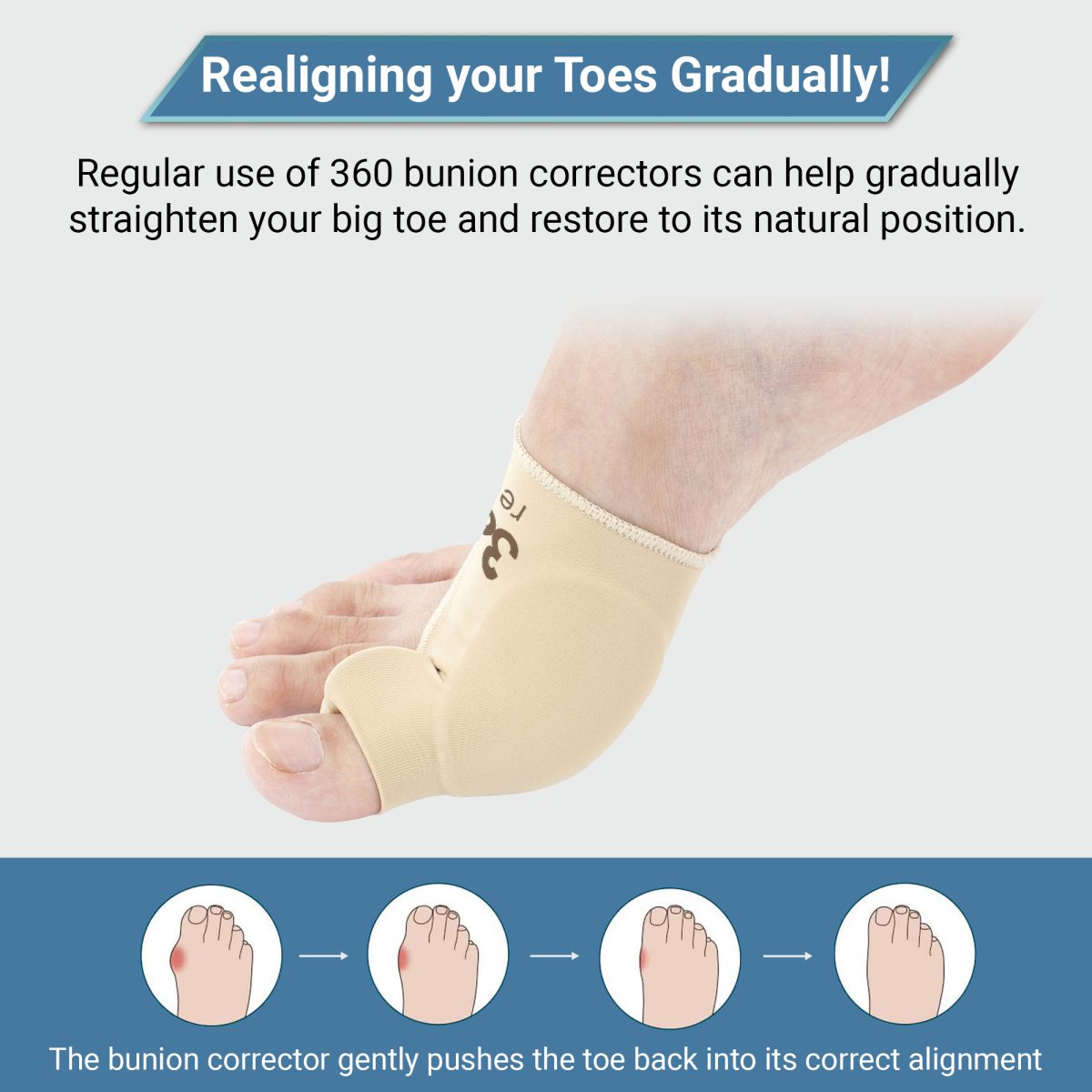 Buy Pair Of Bunion Corrector With Gel Cushions For Toe Realignment ...